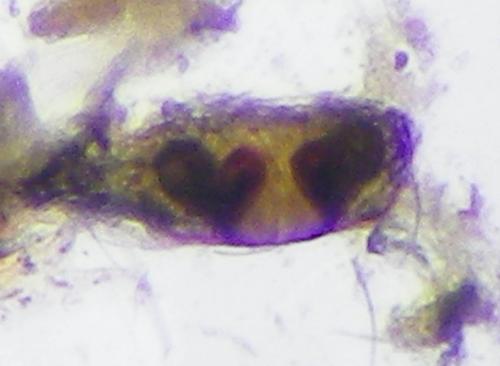 Réf. 273 741 : Oedothorax sp.